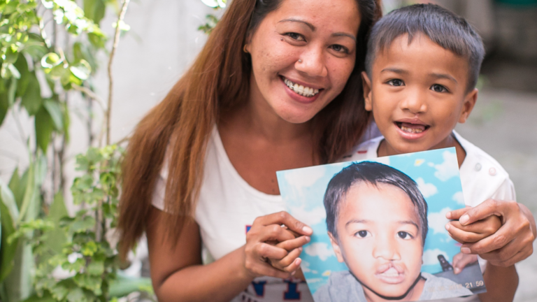 Globe, Smile Train:  Giving Children with Cleft Lips and Palates a Reason to Smile
